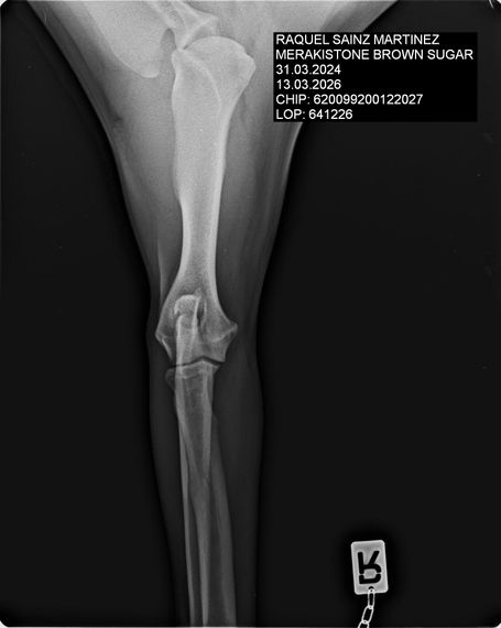 RADIOGRAFIA CODOS
